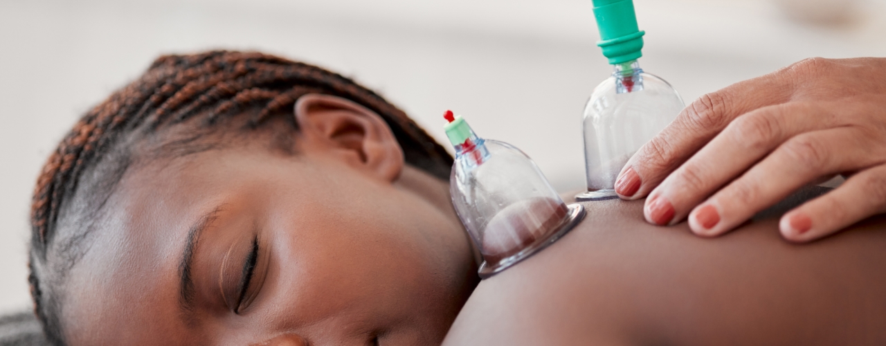 Cupping-Beyond-Physical-Therapy-Franklin-TN