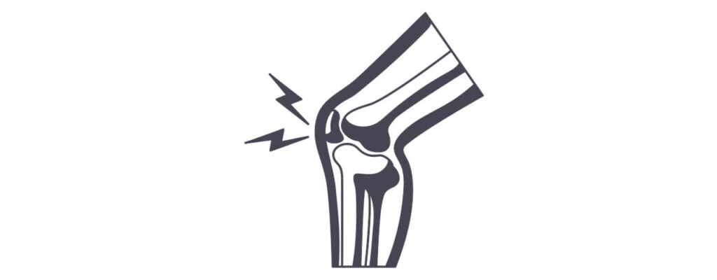 knee Pain Relief in Kentucky